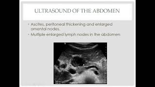 Radiologic features of mesenteric and omental pathologies [upl. by Atoel664]