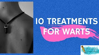 10 Treatments for Warts [upl. by Esidnak]