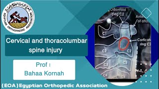 Cervical and thoracolumbar spine injuryProfBahaa Kornah [upl. by Trina944]