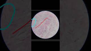 White Fibrocartilage Histology Anatomy 1st year MBBS [upl. by Seely966]