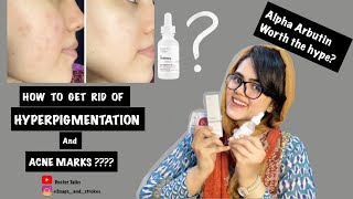 How to get rid of Hyperpigmentation and Acne marks  The ordinary alpha Arbutin review  Dermatology [upl. by Travis739]