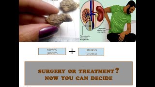 KIDNEY STONE renalcalculi renalcare casepresentation [upl. by Flip]