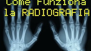 Come funziona la RADIOGRAFIA [upl. by Ykcir489]