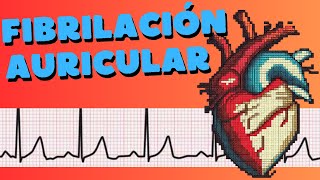 ¿Qué es la fibrilación auricular [upl. by Arrio]