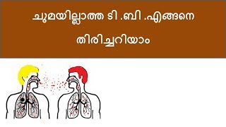 Tuberculous infection Malayalam [upl. by Iluj]