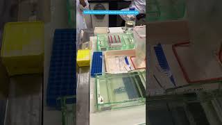 Agarose Gel Electrophoresis electrophoresis DNA analysisofnucleicacid molecularbiology [upl. by Wan]