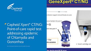 Cepheid Xpert® CTNG Pointofcare Rapid Test Addressing Chlamydia and Gonorrhea [upl. by Ellehcsor]