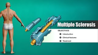 Multiple sclerosis  causes symptoms diagnosis treatment pathology [upl. by Sudoeht]