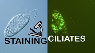 Staining Ciliates for fluorescent microscopy [upl. by Nightingale421]