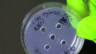 How To Perform An Ouchterlony Assay Double Immunodiffusion Assay [upl. by Ydnis]