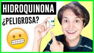 COMO ACLARAR LA PIEL CON HIDROQUINONA  ANTES Y DESPUÉS  ¿ES PELIGROSA  MELASMA  AndyZaturno [upl. by Kcirdet314]