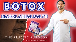 BOTOX  Nasolabialfalte  Nasolabial Fold  Dr Alawi [upl. by Auoz517]