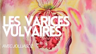 Les varices vulvaires [upl. by Meares973]