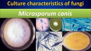 Microsporum canisculture characteristics of fungi [upl. by Giliane142]