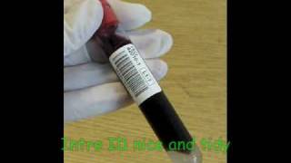 The Phlebotomy Rap [upl. by Utas]