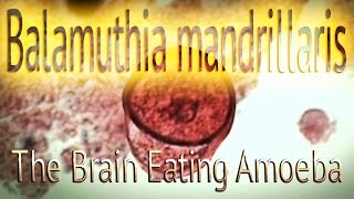 Balamuthia mandrillaris  The Brain Eating Amoeba [upl. by Dugan]