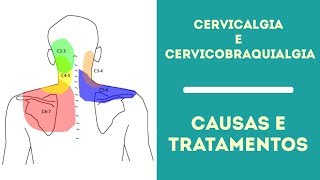 Cervicalgia e Cervicobraquialgia Causas e Tratamentos [upl. by Walliw]