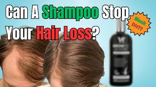 Does DHT Blocking Shampoos work  Best Shampoo for Hair Loss [upl. by Enirehtahc]