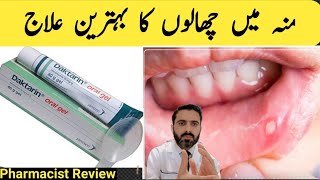 Mouth ulcer  Mouth sores Oral Fungal infection treatment  Daktarin oral gel How to use Review [upl. by Ver]