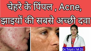 Berberis aquifoliumMedicine for acnepigmentationscars berberisaquifolium shorts acne  pimple [upl. by Aisereht346]