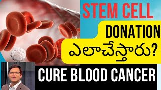 Stem Cell Donation Process Stem Cell Bone MarrowTransplant For Blood Cancer  US Hematologist [upl. by Thisbee]