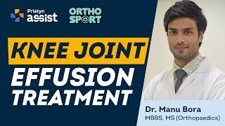 Knee Joint Effusion Kya Hain  What Causes Knee Joint Effusion  Knee Joint Effusion Treatment [upl. by Tally]