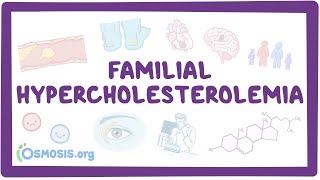 Familial hypercholesterolemia  an Osmosis Preview [upl. by Altis64]