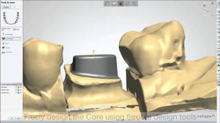 Dental System 2013  Faux Moignon  3shape Dental System 2013  Post amp Core [upl. by Jasik]