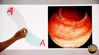 Exploring Total Internal Reflection in Fiber Optics Endoscopy  MCAT Physics Review [upl. by Ian]