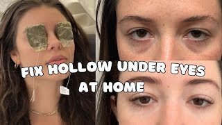 Fix Hollow Under Eyes Naturally at Home  Get Rid Of Hollow Under Eyes 👀 [upl. by Kiersten809]