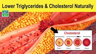 Simple Ways To Lower Triglycerides And Cholesterol Naturally [upl. by Solracesoj323]