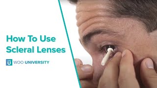 How To Insert and Remove Scleral Lenses [upl. by Enahsed967]