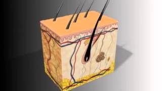 How electrolysis works New Finish Electrolysis [upl. by Adest]