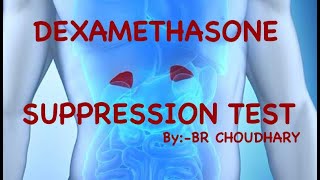 DEXAMETHASONE SUPPRESSION TEST CUSHING DISEASE  CUSHING SYNDROME  DEXAMETHASONE STRESS TEST [upl. by Notsnarc25]