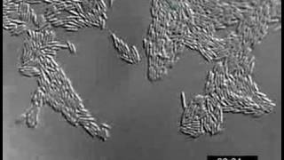 Pseudomonas aeruginosa twitching motility YFPPilU [upl. by Siobhan84]