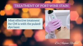 Port Wine Stain Causes Syndromes Symptoms Diagnosis and Treatment  Facial Birth Marks [upl. by Aserat964]