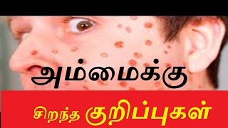 அம்மைக்கு சிறந்த குறிப்புகள்  Best tips for chickenpox  Sithar  Siththarkal  MoYoKo [upl. by Ybocaj105]