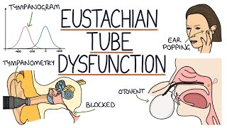 Understanding Eustachian Tube Dysfunction [upl. by Ahsyekal]