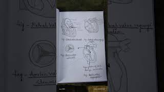 Assignment on valvular heart disease MSNIIgnm2ndyear bscnursing assignment notes study [upl. by Yecram]