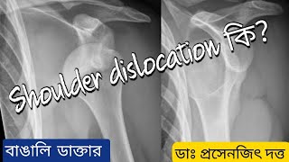 Shoulder dislocation treatment without surgery reducing technique diagnosis in bengali [upl. by Bonnibelle570]