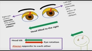 How to remember Cranial Nerves part 3 Trochlear nerve function and palsy [upl. by Ardnalahs]