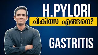 Hpylori ചികിത്സ എങ്ങനെ  Dr Sijil K S [upl. by Yeo]