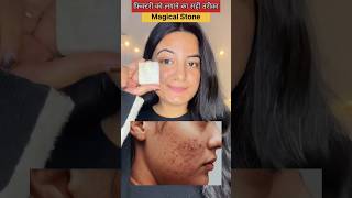 😮 Fitkariफिटकरी लगाने का सही तरीका ऐसे लगाओ Pimple दाग धब्बे सब गायब हो जायेगा😮💓🎀alum fitkari [upl. by Adall]