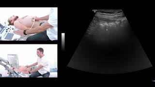 How to perform an ultrasound exam of the gastrointestinal GI tract [upl. by Rozalin]