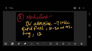 Supraventricular Tachycardia svt [upl. by Parik352]