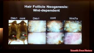 Dr George Cotsarelis Hair Follicle Stem Cells amp Skin Regeneration [upl. by Knight997]