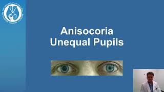 Anisocoria  Unequal Pupil Size [upl. by Cirdet604]