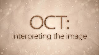 OCT Interpreting the image [upl. by Braden]