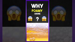 Why quot Foamy quot Urine [upl. by Weisbrodt534]