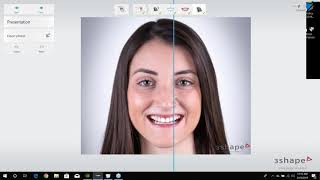 Webinar Smile Design in 3Shape An Overview with Brandon Smith CDT [upl. by Iarahs]